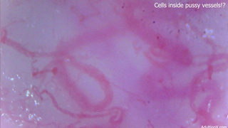 Cells moving inside snatch vessels!